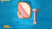 Operación de epilepsia
